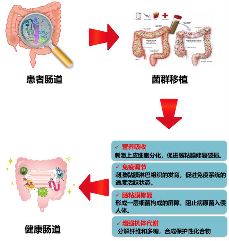 粪菌移植厂家